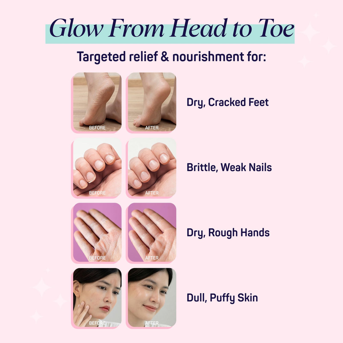 SpaLife Moisturizing Foot Sockies | Foot Mask for Dry Cracked Feet | Tea Tree Oil Softening Booties | Callus Remover Alternative | Self Care Gifts for Women | 8 Pack