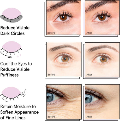 grace & stella Under Eye Patches (12 pairs) Eye Masks for Puffy Eyes and Dark Circles - Gifts for Women, Bridesmaids, Birthdays, Bachelorette Party, Self Care Gifts for Women - Vegan Cruelty-Free