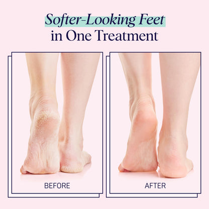 SpaLife Moisturizing Foot Sockies | Foot Mask for Dry Cracked Feet | Tea Tree Oil Softening Booties | Callus Remover Alternative | Self Care Gifts for Women | 8 Pack