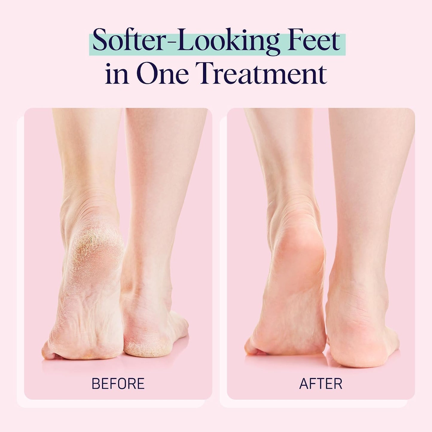 SpaLife Moisturizing Foot Sockies | Foot Mask for Dry Cracked Feet | Tea Tree Oil Softening Booties | Callus Remover Alternative | Self Care Gifts for Women | 8 Pack
