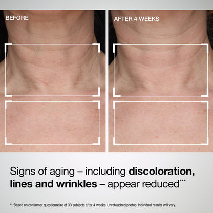 StriVectin Tighten and Lift Advanced Neck Cream PLUS with Alpha-3 Peptides for Neck and Décolleté, Smoothing Look of Wrinkles and Fine Lines, Improves Crepey Skin and Vertical Lines