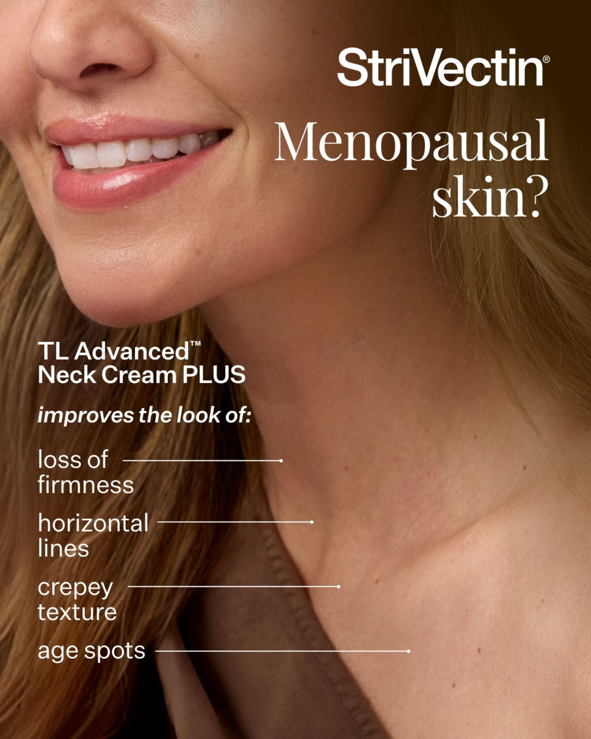 StriVectin Tighten and Lift Advanced Neck Cream PLUS with Alpha-3 Peptides for Neck and Décolleté, Smoothing Look of Wrinkles and Fine Lines, Improves Crepey Skin and Vertical Lines
