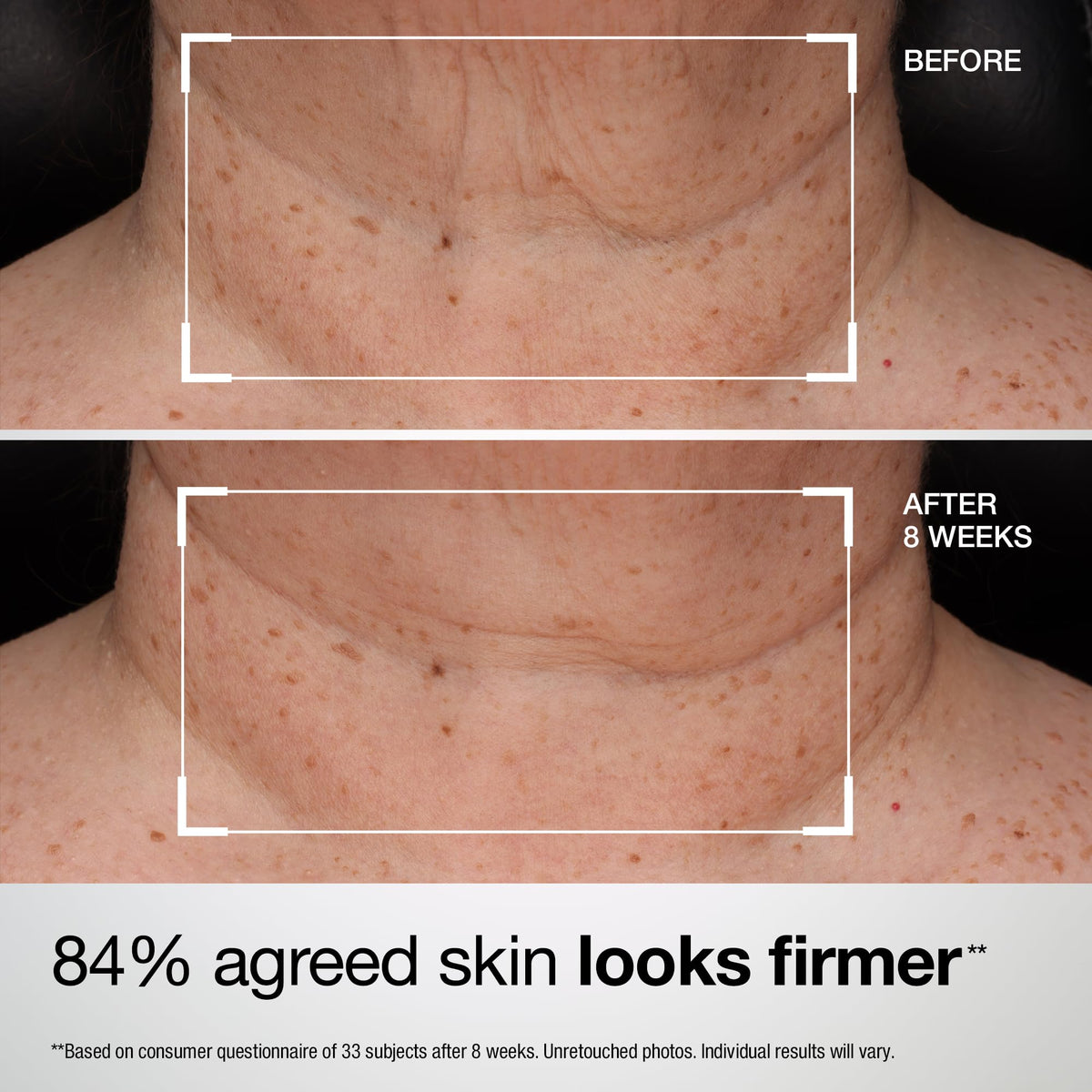 StriVectin Tighten and Lift Advanced Neck Cream PLUS with Alpha-3 Peptides for Neck and Décolleté, Smoothing Look of Wrinkles and Fine Lines, Improves Crepey Skin and Vertical Lines