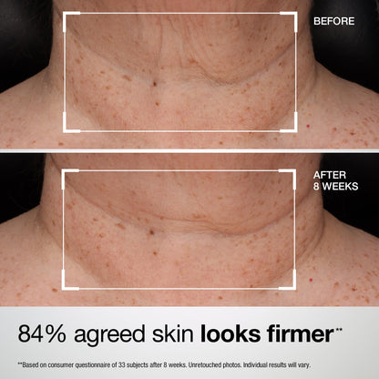 StriVectin Tighten and Lift Advanced Neck Cream PLUS with Alpha-3 Peptides for Neck and Décolleté, Smoothing Look of Wrinkles and Fine Lines, Improves Crepey Skin and Vertical Lines